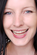 Lachen