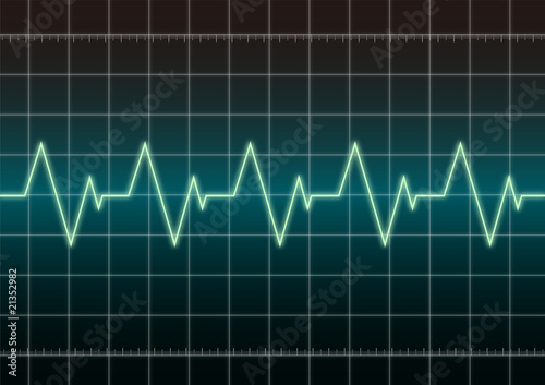Illustration: cardiogram cardiogram