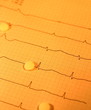 EKG