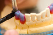 Working dental technician