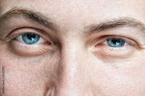 Photo: Closeup of young man's blue eyes with problematic skin Closeup of young man's blue eyes with problematic skin