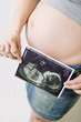 L'echo de bébé