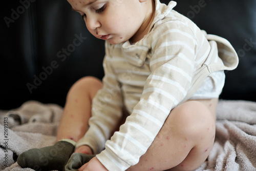 Photo: Kinderkrankheit Kinderkrankheit