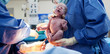 Baby being born via Caesarean Section Baby being born via Caesarean Section