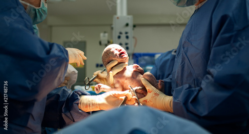 Borning Baby Video on Baby Being Born Via Caesarean Section Martin Valigursky 21748736