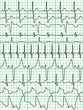Cardiogram