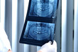 Dentist looking at x ray of patients teeth
