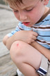 Scraped knee