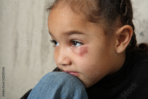 Photo: Child abuse Child abuse