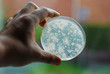 Bacteria growing