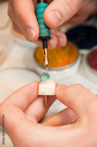 Photo: Making of a Tooth Crown Making of a Tooth Crown