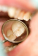 dental exam