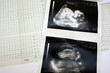 cardiograph and ultrasound