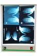 X-ray photograph