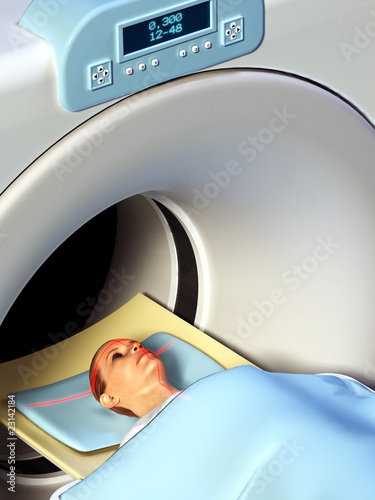 Illustration: Head x-ray Head x-ray