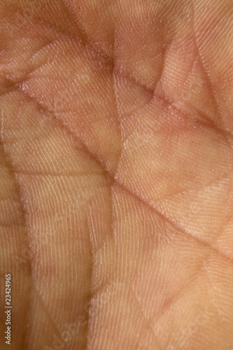 Photo: skin skin
