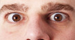 eyes