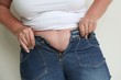 Knappe Hose
