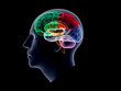 Xray head with sectioned brain
