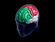 Xray head with sectioned brain - front