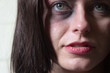 Close-up of beautiful woman with black-eye