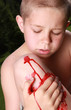 Young boy with injured knee