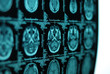 MRI scan of human brain MRI scan of human brain