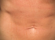 Photo: human skin human skin