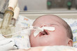 Newborn baby inside incubator