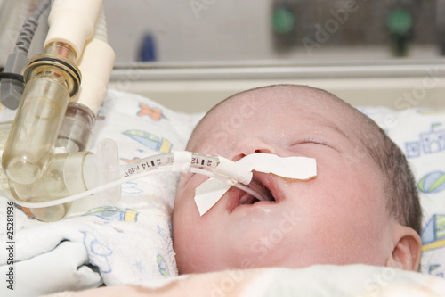 Photo: Newborn baby inside incubator Newborn baby inside incubator