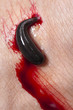 Blood sucking leech