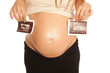 femme enceinte echographie
