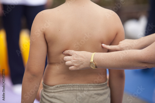 Photo: childhood obesity childhood obesity