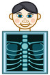 X-ray