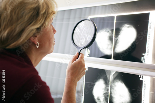 Foto: Mammographie Mammographie