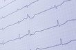 EKG