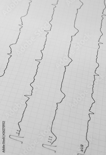 Foto: EKG EKG