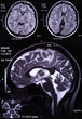 X-ray image of the brain