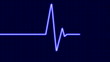 Cardiogram