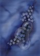 Norovirus