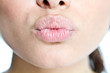 kiss
