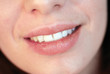 Foto: Shot of beautiful young girl with dry lips smiling Shot of beautiful young girl with dry lips smiling