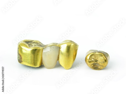 Foto: Zahngold, Goldzähne Zahngold, Goldzähne
