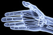 hand
