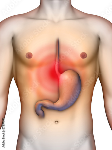 Illustration: Heartburn Heartburn