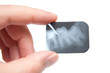 tooth x-ray