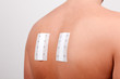 Foto: allergie test allergie test