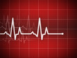 cardiogram