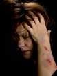 After attack