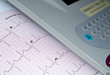Electrocardiogram.